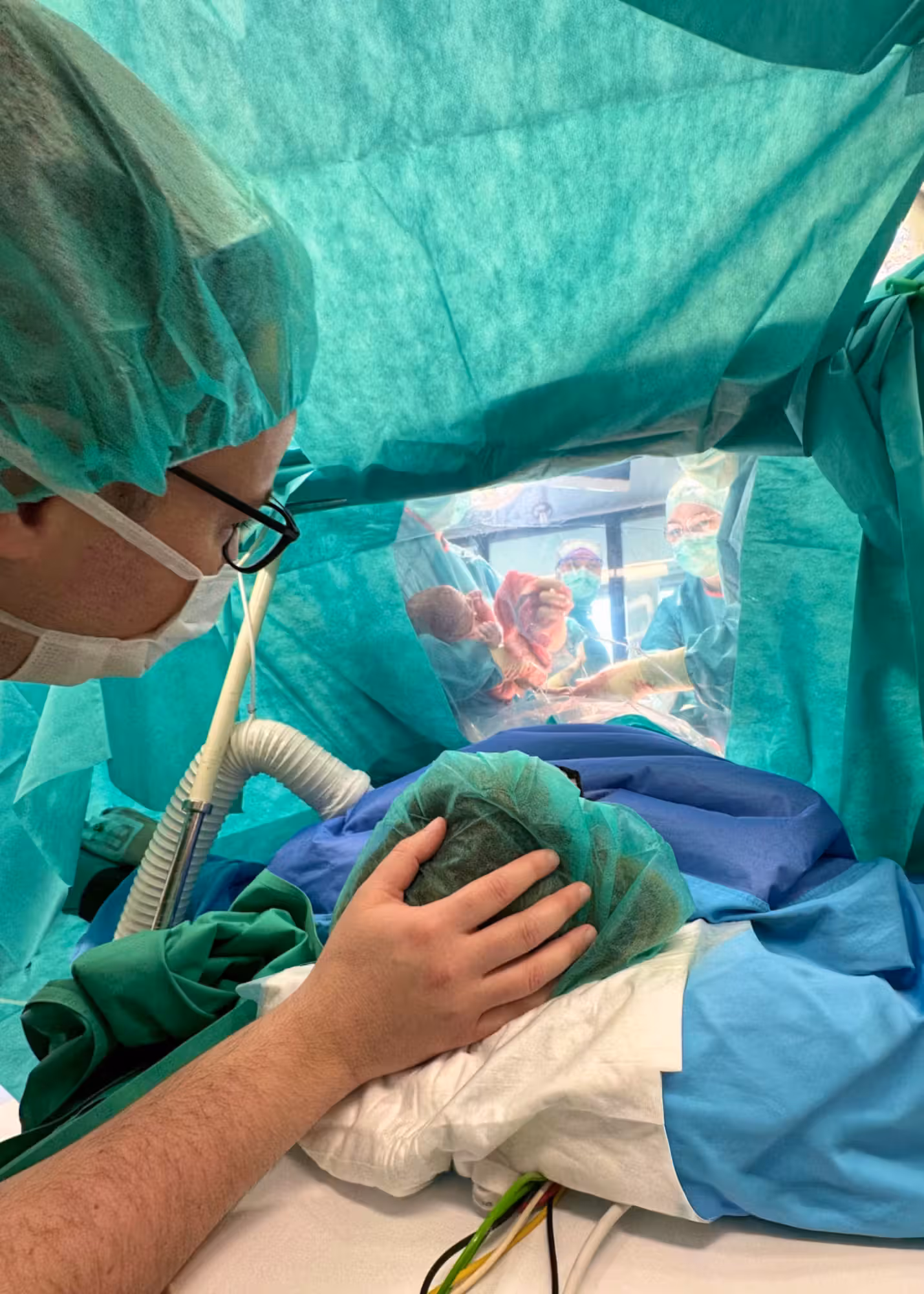 Syndrome prémenstruel : comprendre les symptômes, le diagnostic et les options de prise en charge